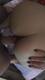 anal
